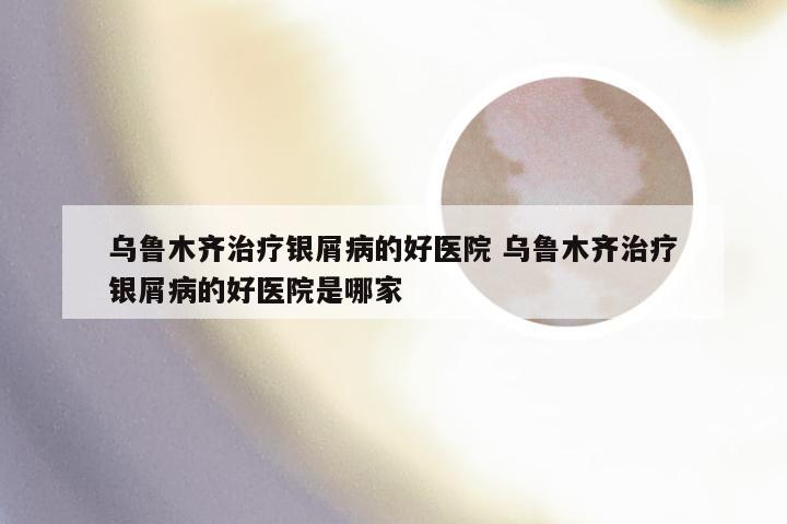 乌鲁木齐治疗银屑病的好医院 乌鲁木齐治疗银屑病的好医院是哪家