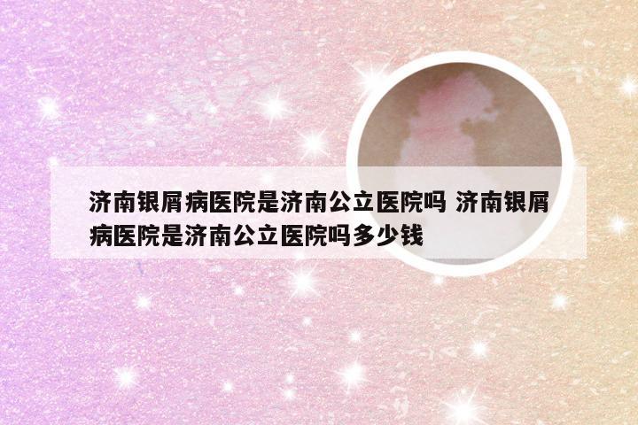 济南银屑病医院是济南公立医院吗 济南银屑病医院是济南公立医院吗多少钱