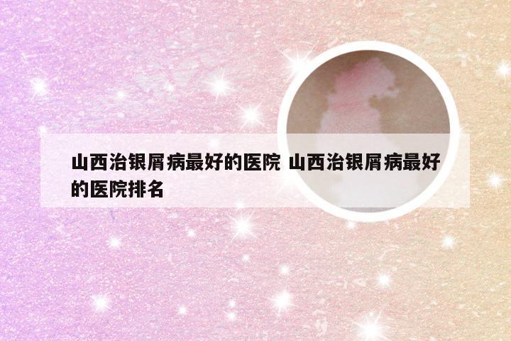 山西治银屑病最好的医院 山西治银屑病最好的医院排名