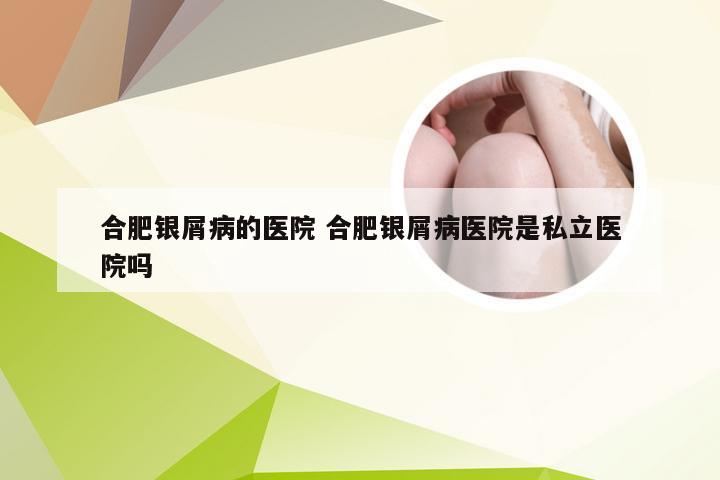 合肥银屑病的医院 合肥银屑病医院是私立医院吗