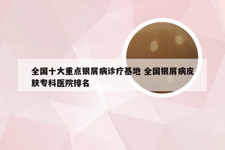 全国十大重点银屑病诊疗基地 全国银屑病皮肤专科医院排名