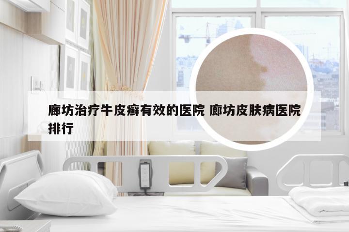 廊坊治疗牛皮癣有效的医院 廊坊皮肤病医院排行