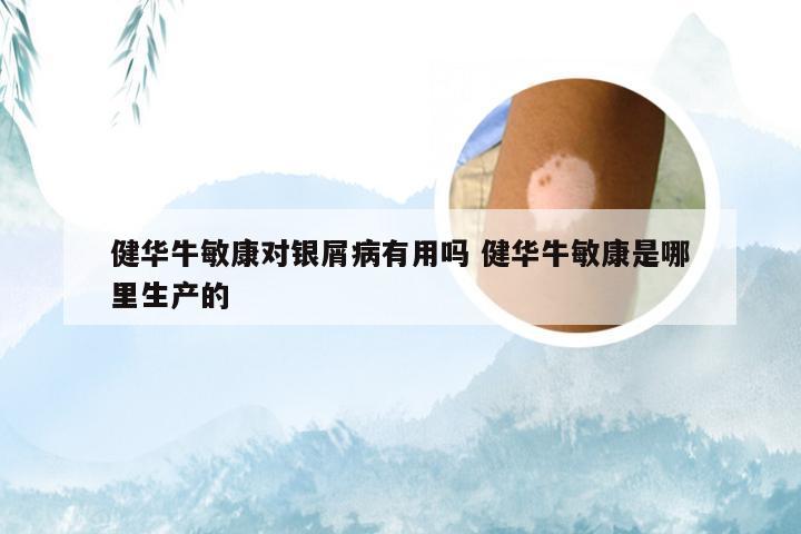 健华牛敏康对银屑病有用吗 健华牛敏康是哪里生产的