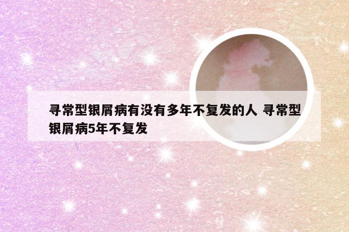 寻常型银屑病有没有多年不复发的人 寻常型银屑病5年不复发
