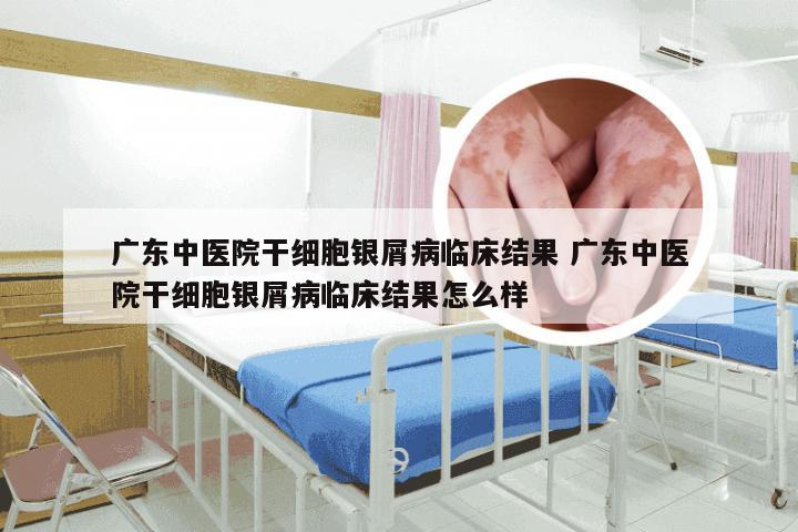 广东中医院干细胞银屑病临床结果 广东中医院干细胞银屑病临床结果怎么样