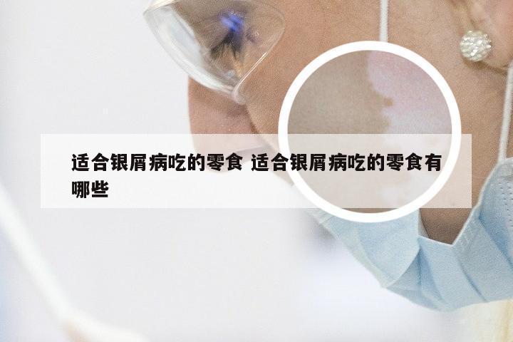 适合银屑病吃的零食 适合银屑病吃的零食有哪些