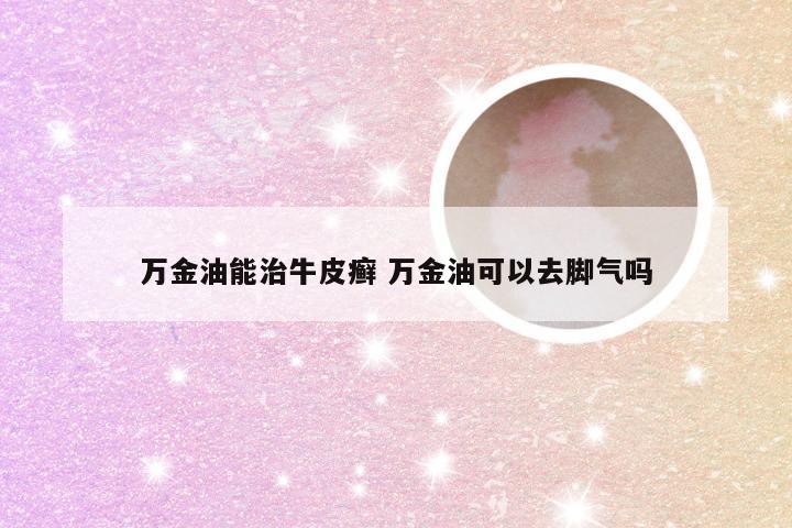 万金油能治牛皮癣 万金油可以去脚气吗