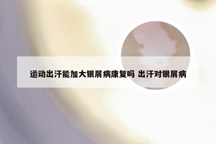 运动出汗能加大银屑病康复吗 出汗对银屑病