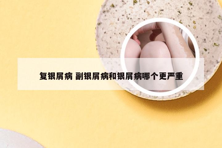 复银屑病 副银屑病和银屑病哪个更严重