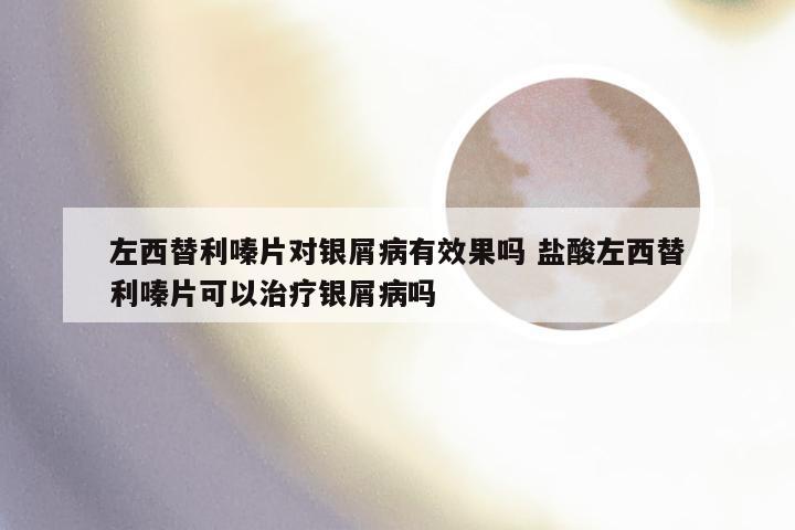 左西替利嗪片对银屑病有效果吗 盐酸左西替利嗪片可以治疗银屑病吗