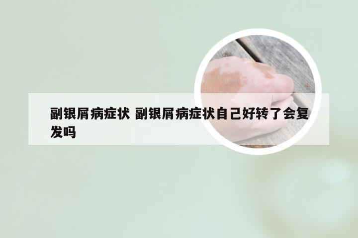 副银屑病症状 副银屑病症状自己好转了会复发吗