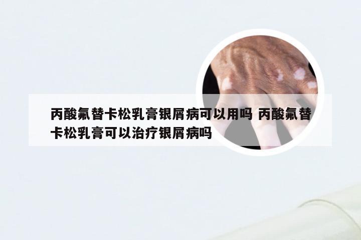 丙酸氟替卡松乳膏银屑病可以用吗 丙酸氟替卡松乳膏可以治疗银屑病吗