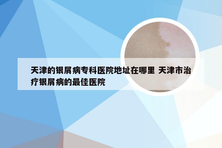 天津的银屑病专科医院地址在哪里 天津市治疗银屑病的最佳医院