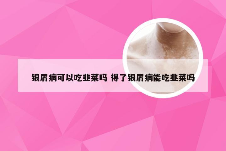 银屑病可以吃韭菜吗 得了银屑病能吃韭菜吗