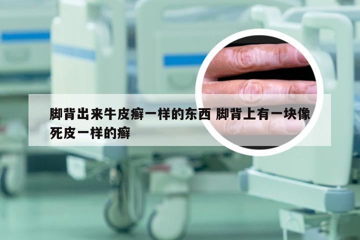 脚背出来牛皮癣一样的东西 脚背上有一块像死皮一样的癣