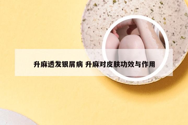 升麻透发银屑病 升麻对皮肤功效与作用
