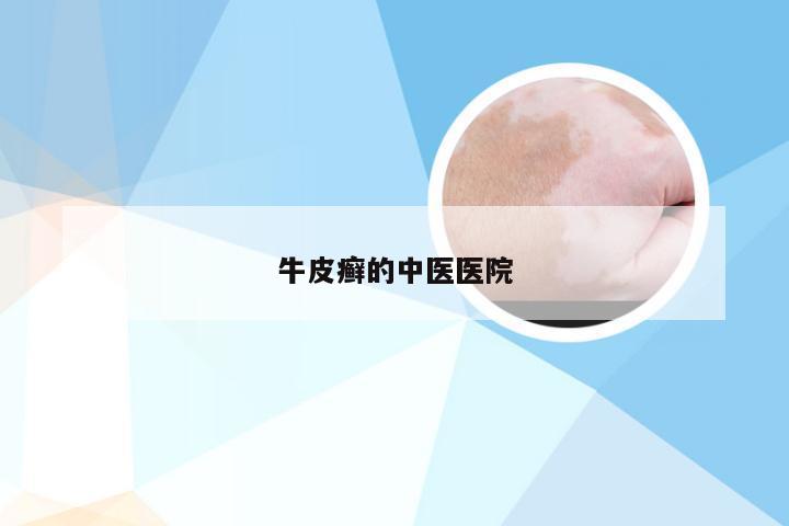 牛皮癣的中医医院