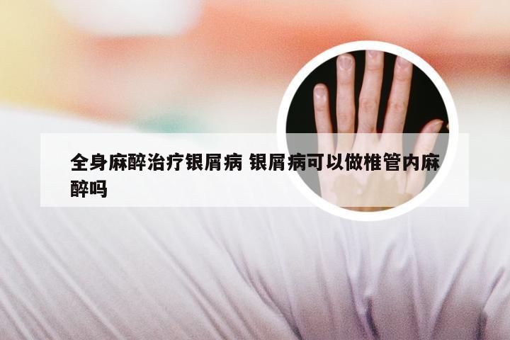 全身麻醉治疗银屑病 银屑病可以做椎管内麻醉吗