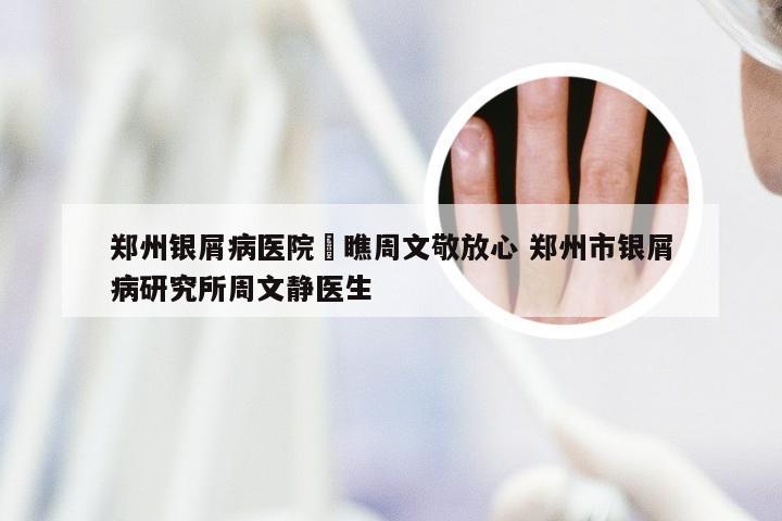 郑州银屑病医院來瞧周文敬放心 郑州市银屑病研究所周文静医生