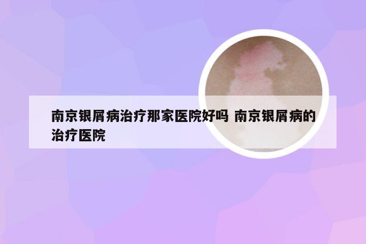 南京银屑病治疗那家医院好吗 南京银屑病的治疗医院