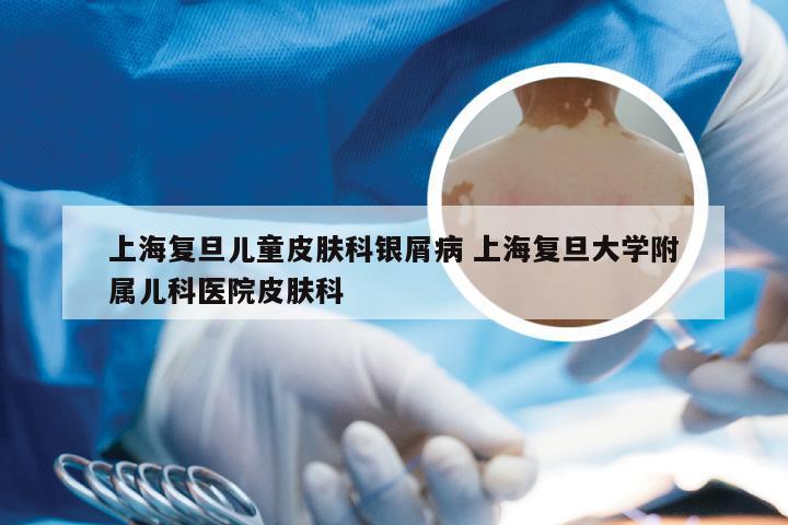 上海复旦儿童皮肤科银屑病 上海复旦大学附属儿科医院皮肤科