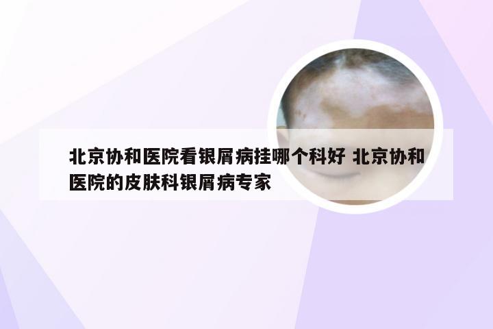 北京协和医院看银屑病挂哪个科好 北京协和医院的皮肤科银屑病专家