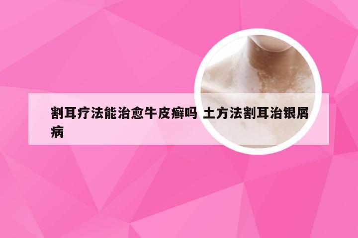 割耳疗法能治愈牛皮癣吗 土方法割耳治银屑病