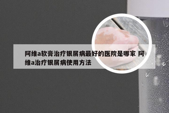 阿维a软膏治疗银屑病最好的医院是哪家 阿维a治疗银屑病使用方法