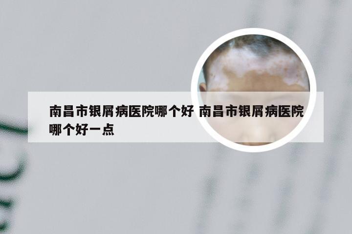 南昌市银屑病医院哪个好 南昌市银屑病医院哪个好一点