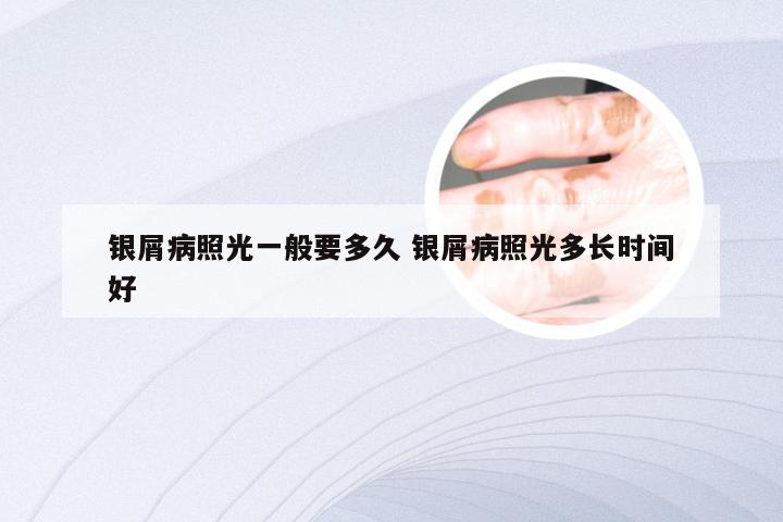 银屑病照光一般要多久 银屑病照光多长时间好