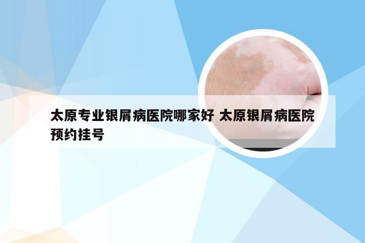太原专业银屑病医院哪家好 太原银屑病医院预约挂号