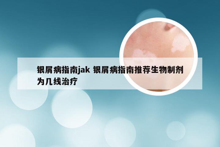 银屑病指南jak 银屑病指南推荐生物制剂为几线治疗
