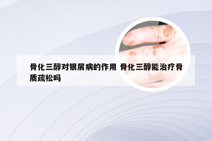 骨化三醇对银屑病的作用 骨化三醇能治疗骨质疏松吗