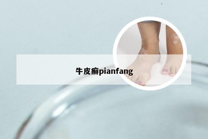 牛皮癣pianfang