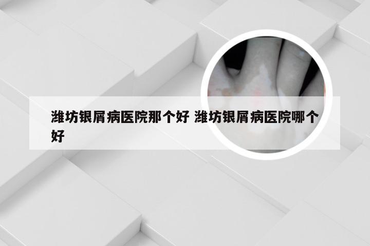 潍坊银屑病医院那个好 潍坊银屑病医院哪个好