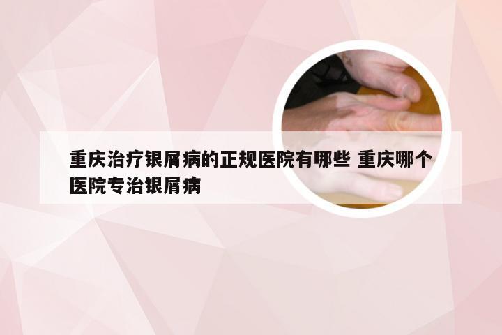 重庆治疗银屑病的正规医院有哪些 重庆哪个医院专治银屑病