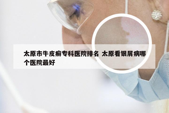太原市牛皮癣专科医院排名 太原看银屑病哪个医院最好