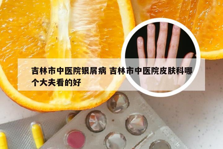 吉林市中医院银屑病 吉林市中医院皮肤科哪个大夫看的好