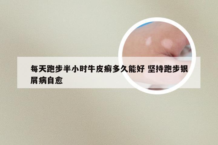 每天跑步半小时牛皮癣多久能好 坚持跑步银屑病自愈