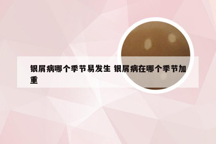 银屑病哪个季节易发生 银屑病在哪个季节加重