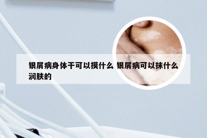 银屑病身体干可以摸什么 银屑病可以抹什么润肤的