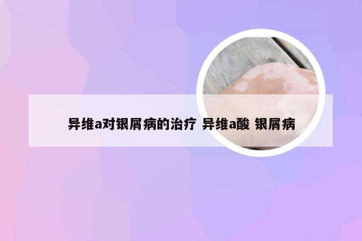 异维a对银屑病的治疗 异维a酸 银屑病