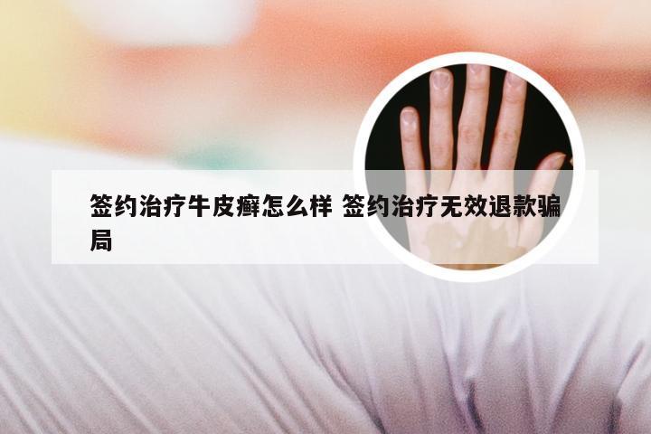 签约治疗牛皮癣怎么样 签约治疗无效退款骗局