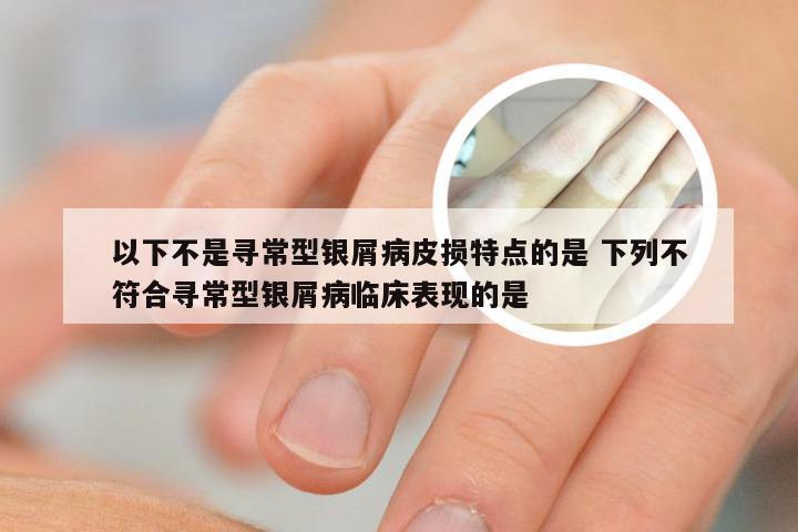 以下不是寻常型银屑病皮损特点的是 下列不符合寻常型银屑病临床表现的是