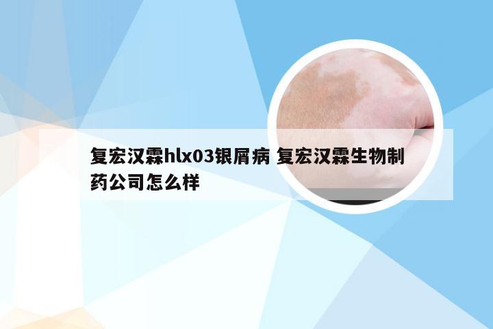 复宏汉霖hlx03银屑病 复宏汉霖生物制药公司怎么样