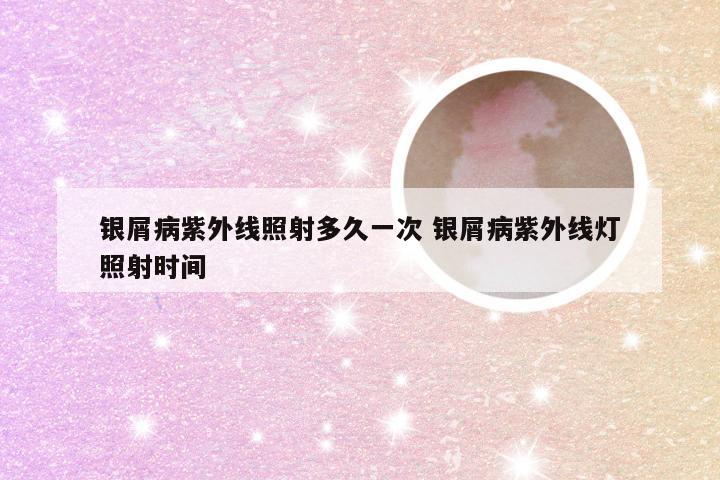 银屑病紫外线照射多久一次 银屑病紫外线灯照射时间