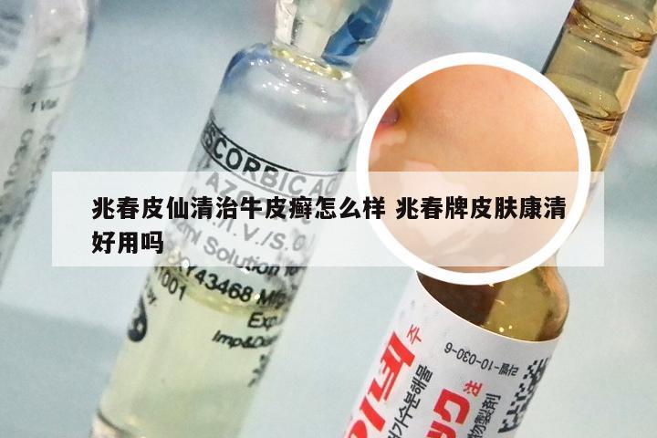 兆春皮仙清治牛皮癣怎么样 兆春牌皮肤康清好用吗