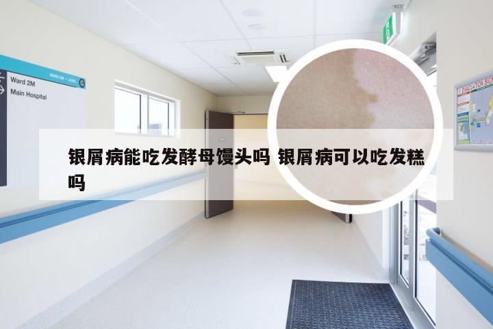 银屑病能吃发酵母馒头吗 银屑病可以吃发糕吗