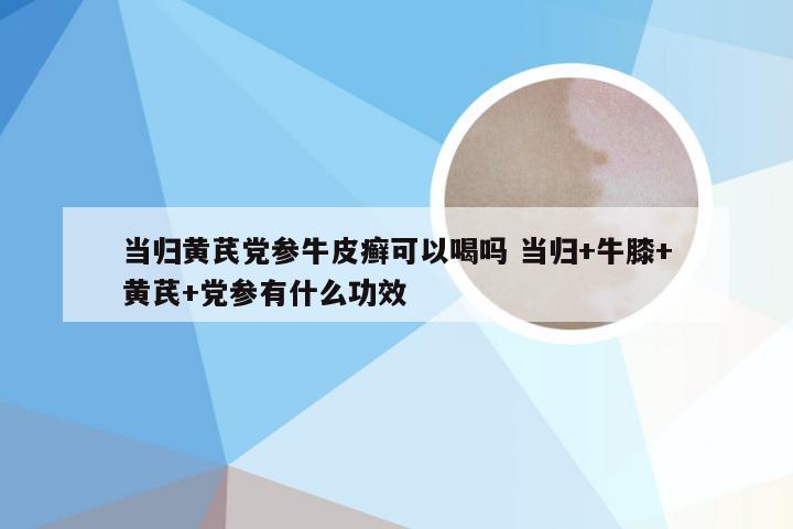 当归黄芪党参牛皮癣可以喝吗 当归+牛膝+黄芪+党参有什么功效