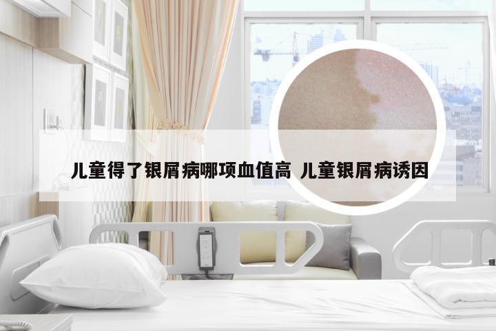 儿童得了银屑病哪项血值高 儿童银屑病诱因
